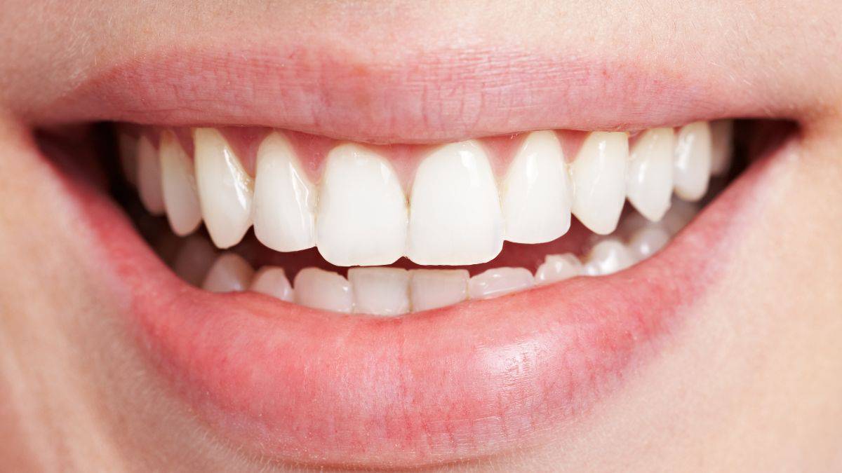 Woman showing white teeth.